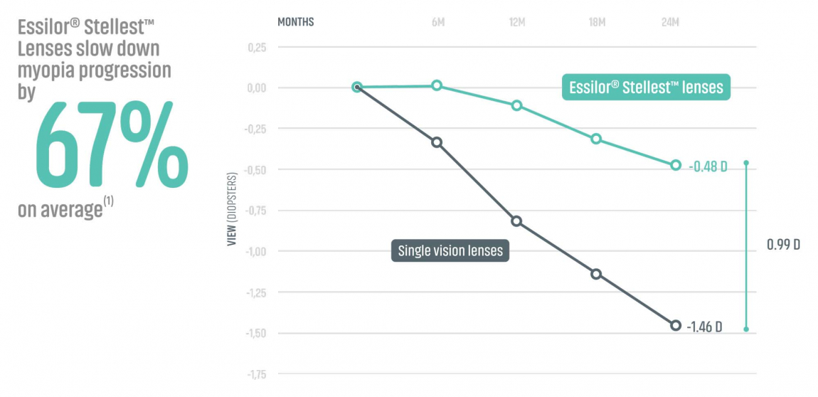 gráfico que muestra la comparación entre la lente Stellest y la lente monofocal