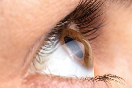 ¿Qué condiciones de salud me impedirán recibir LASIK?