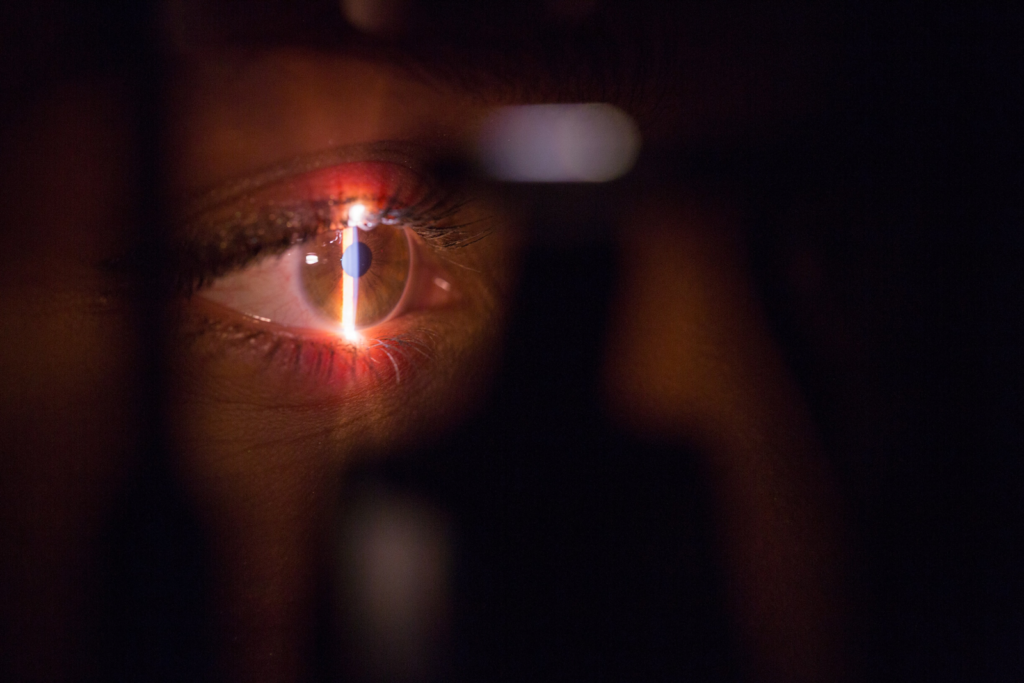 astilla de luz que brilla en un ojo abierto durante un examen de la vista del oftalmólogo